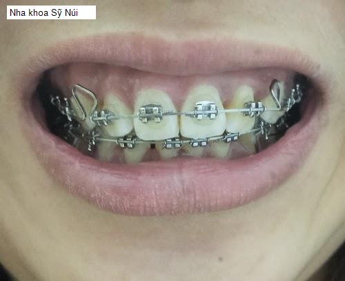 Hình ảnh Nha khoa Sỹ Núi
