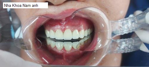 Hình ảnh Nha Khoa Nam anh