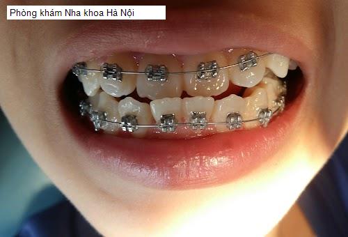 Hình ảnh Phòng khám Nha khoa Hà Nội