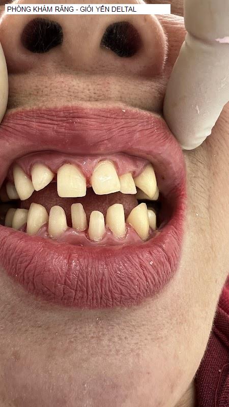 Hình ảnh PHÒNG KHÁM RĂNG - GIỎI YẾN DELTAL
